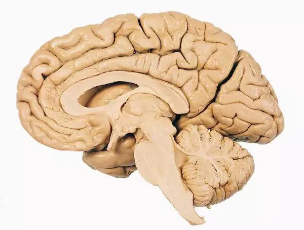 馬斯克腦機融合系統(tǒng)Neuralink