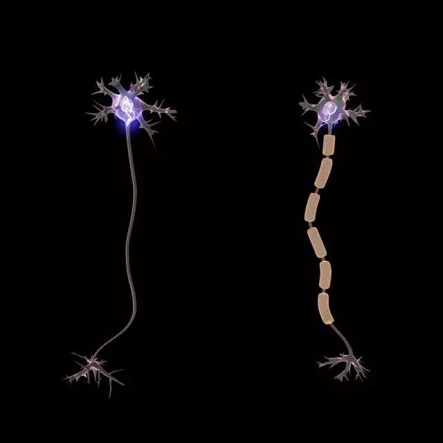 馬斯克腦機融合系統(tǒng)Neuralink
