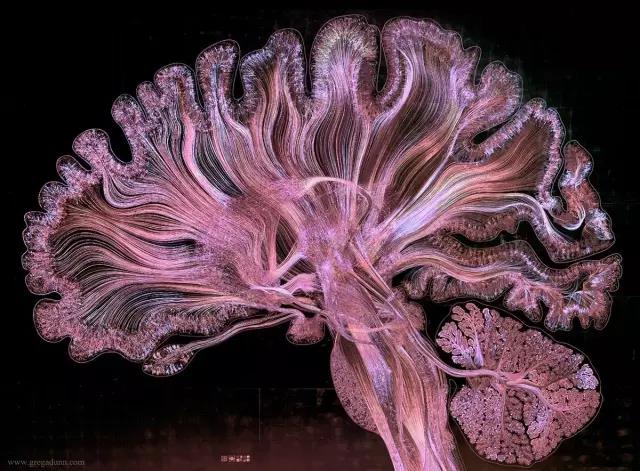 馬斯克腦機融合系統(tǒng)Neuralink